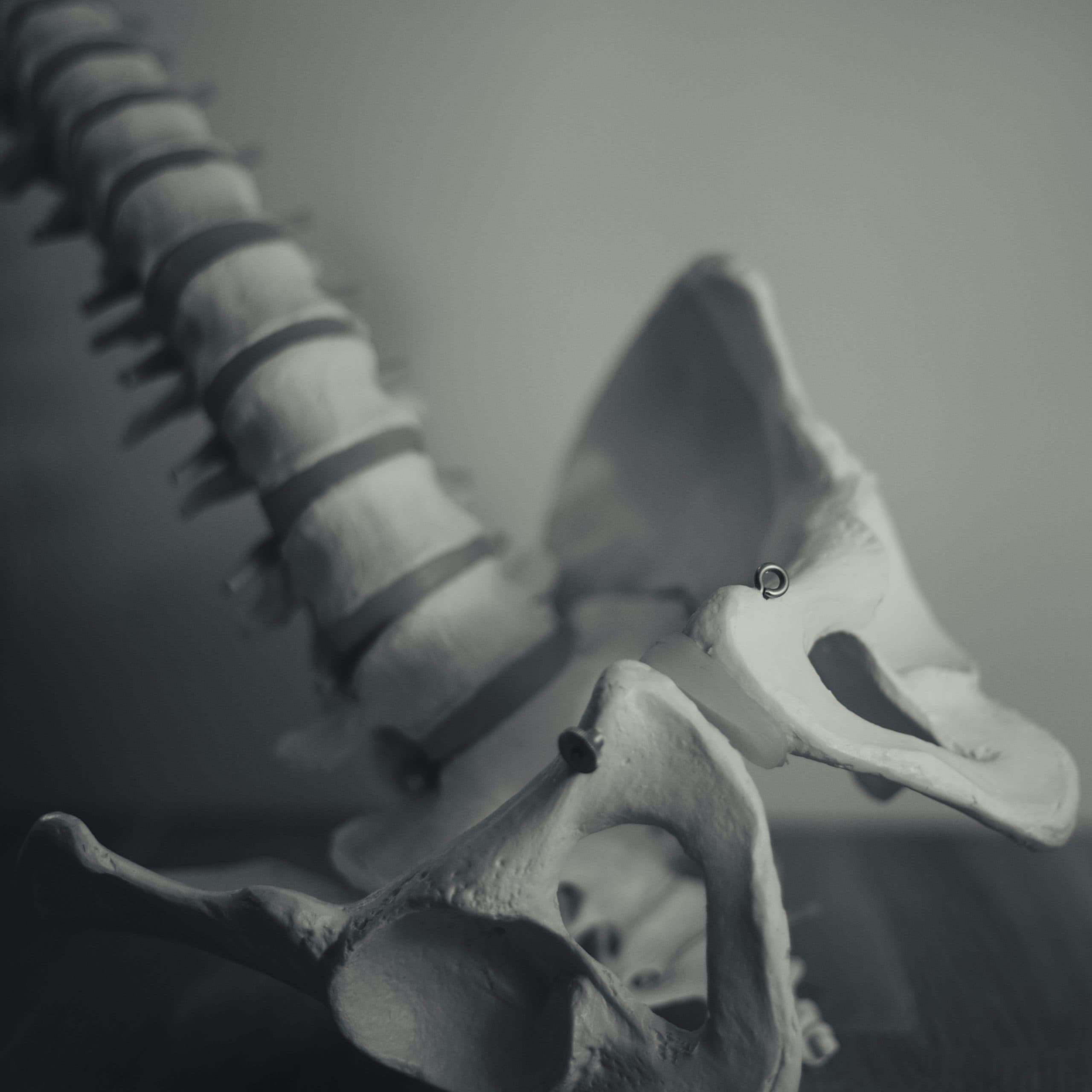 Comprehensive Guide to Spine Pain Causes and Chiropractic Solutions